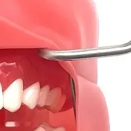 

1PCS Stainless Steel Dental Lip Cheek Retractor Implant Mouth Opener Instrument Teeth Whitening Tools Autoclavable