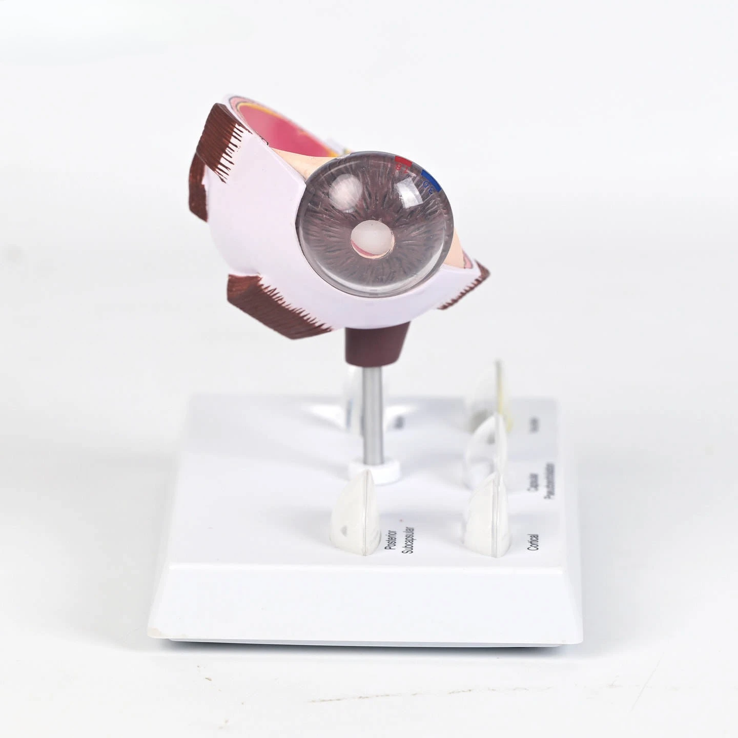 Medical cataract eye model eye anatomy pathology lens opacity ophthalmology teaching