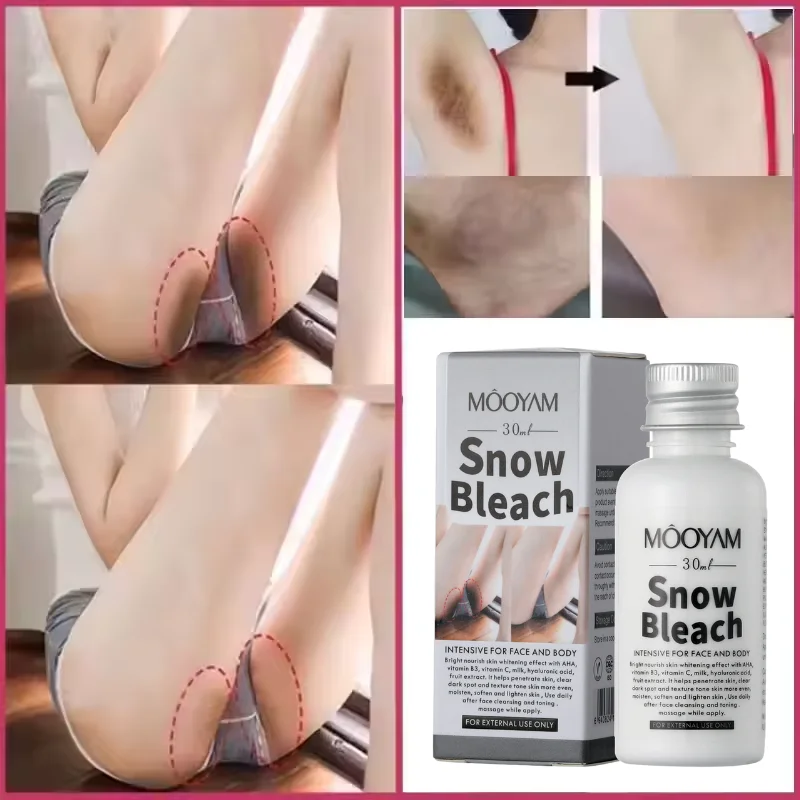 Remove Melanin Body Whitening Snow Bleach Cream Brighten Underarm Elbow Knees Joint Lighten Intimate Part Thigh Inner Dark Spot