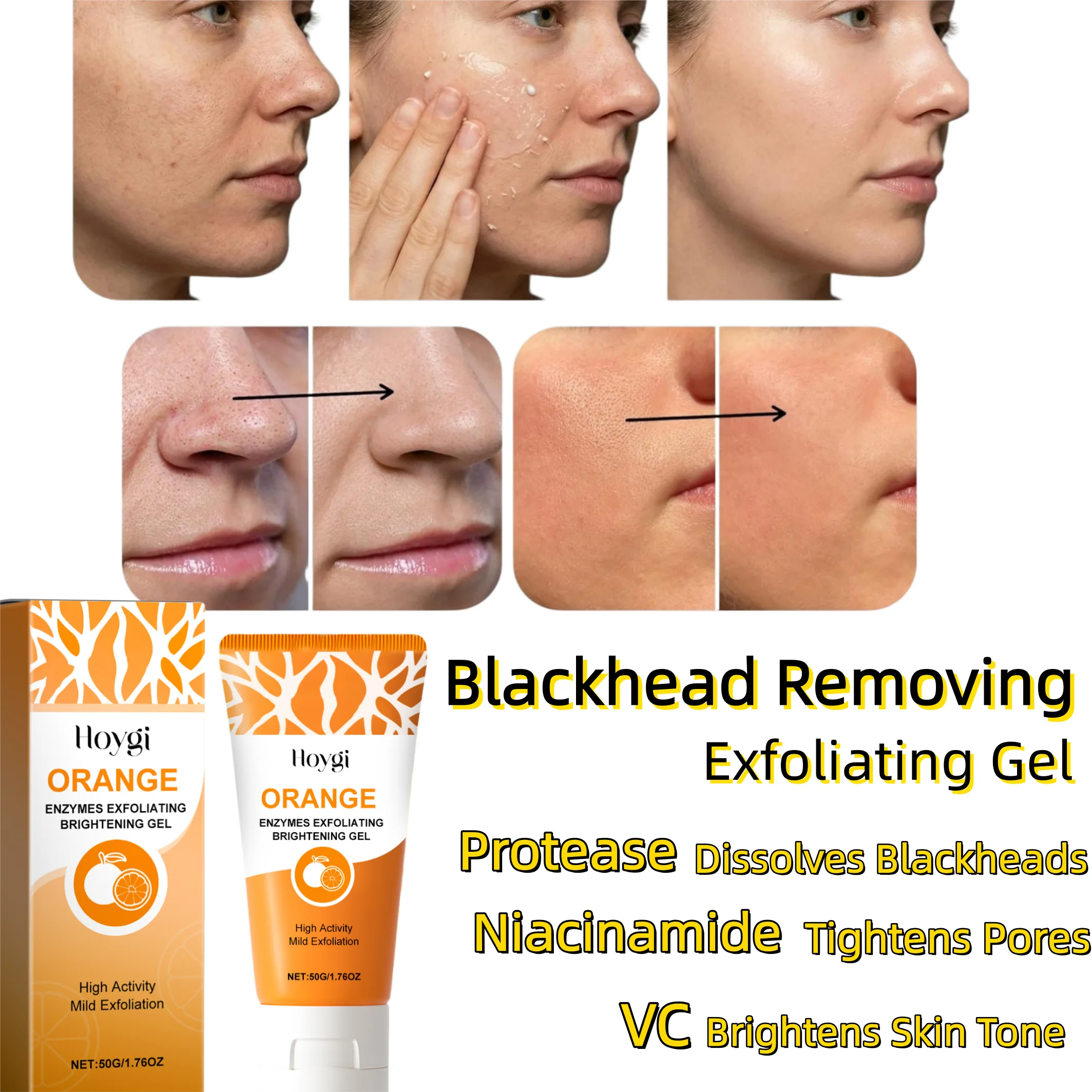 Blackhead Clearing Exfoliating Gel,Blackhead Removal&Full Face Gentle Exfoliating,Protease Fluid Melts Stubborn Blackheads,Clears Blackheads While Preventing Regrowth,Powerful Niacinamide Minimizes Pores,Fades Dullness, Reveals Glass Skin Glow,Vegan