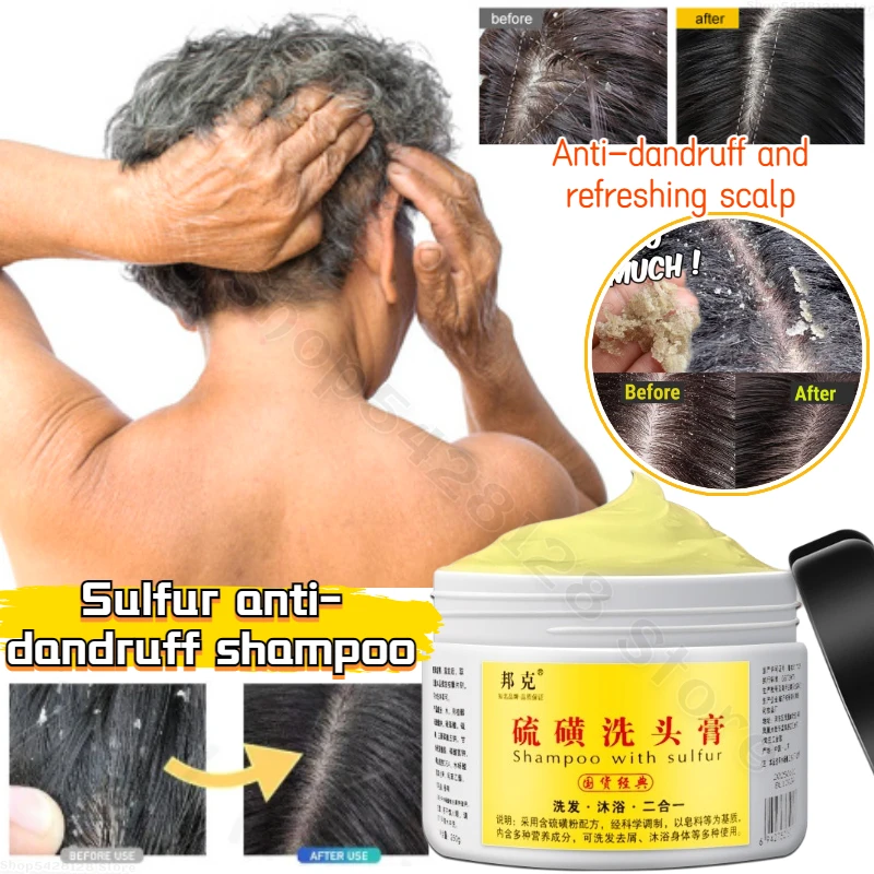 

Sulfur Anti-dandruff Shampoo Soothes The Scalp and Repairs Damaged Hair Follicles Nourishes Hair Roots Anti-dandruff Shampoo