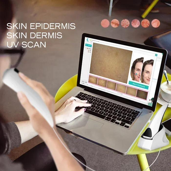 Digital facial skincarisma scope 3 layer 3D visa skin analysis dermaskin logica machine connect with computer use