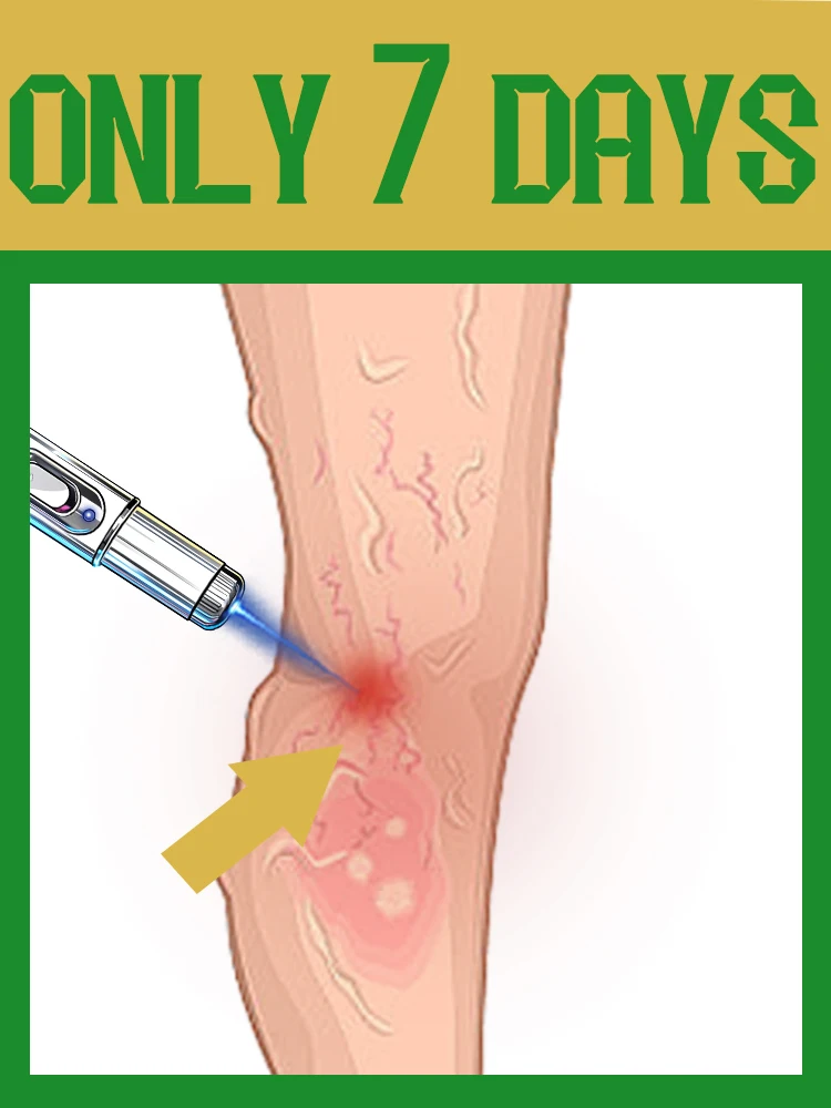 2025 Blue light pen, protecting your health Solve Leg trouble