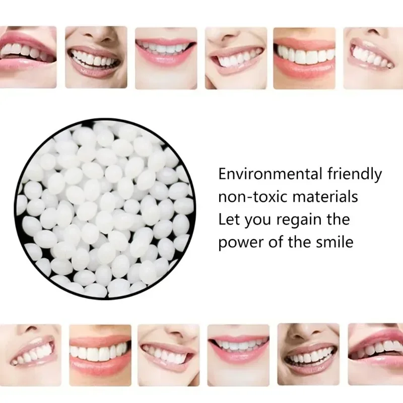 

100g Temporary Tooth Repair Beads Missing Broken Teeth Dental Tooth Filling Material Food Grade FalseTeeth Solid Glue Denture