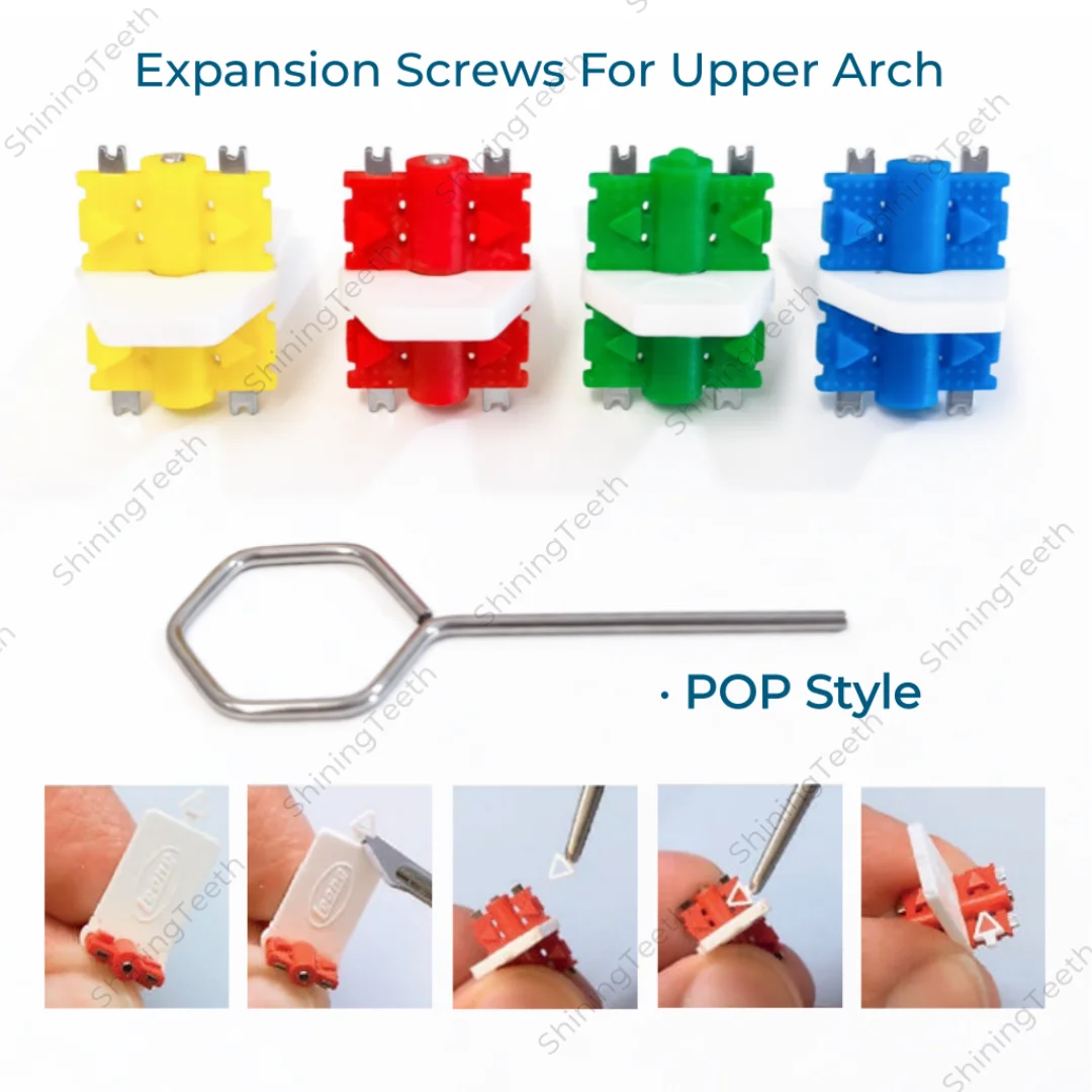 

Ортодонтические расширительные винты 9,0 мм для верхней дуги, полимерные, в стиле Leone POP, цветные