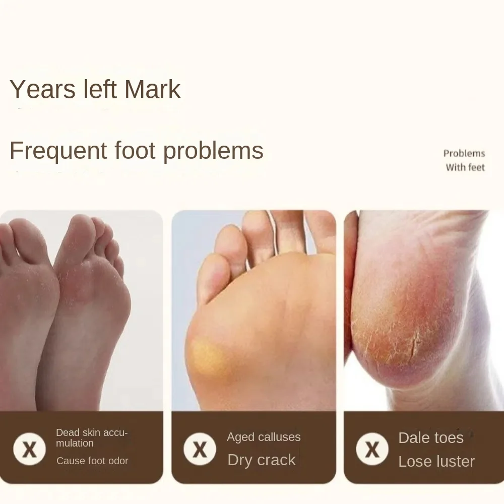 

Cuticle Callus Remover Electric Feet Sander Machine USB Rechargeable Foot Grinder Rupture Skin Trimmer Dead Hard Cracked Skin