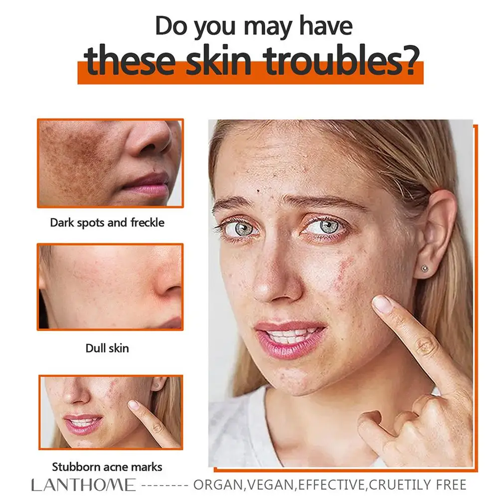 สบู่กรดโคจิกเพื่อความขาวสบู่ล้างมือช่วยให้ผิวขาวผลิตภัณฑ์สร้างจุดด่างดำดูแลผิวหน้าปรับปรุงผิวกำจัด I0D0 BL