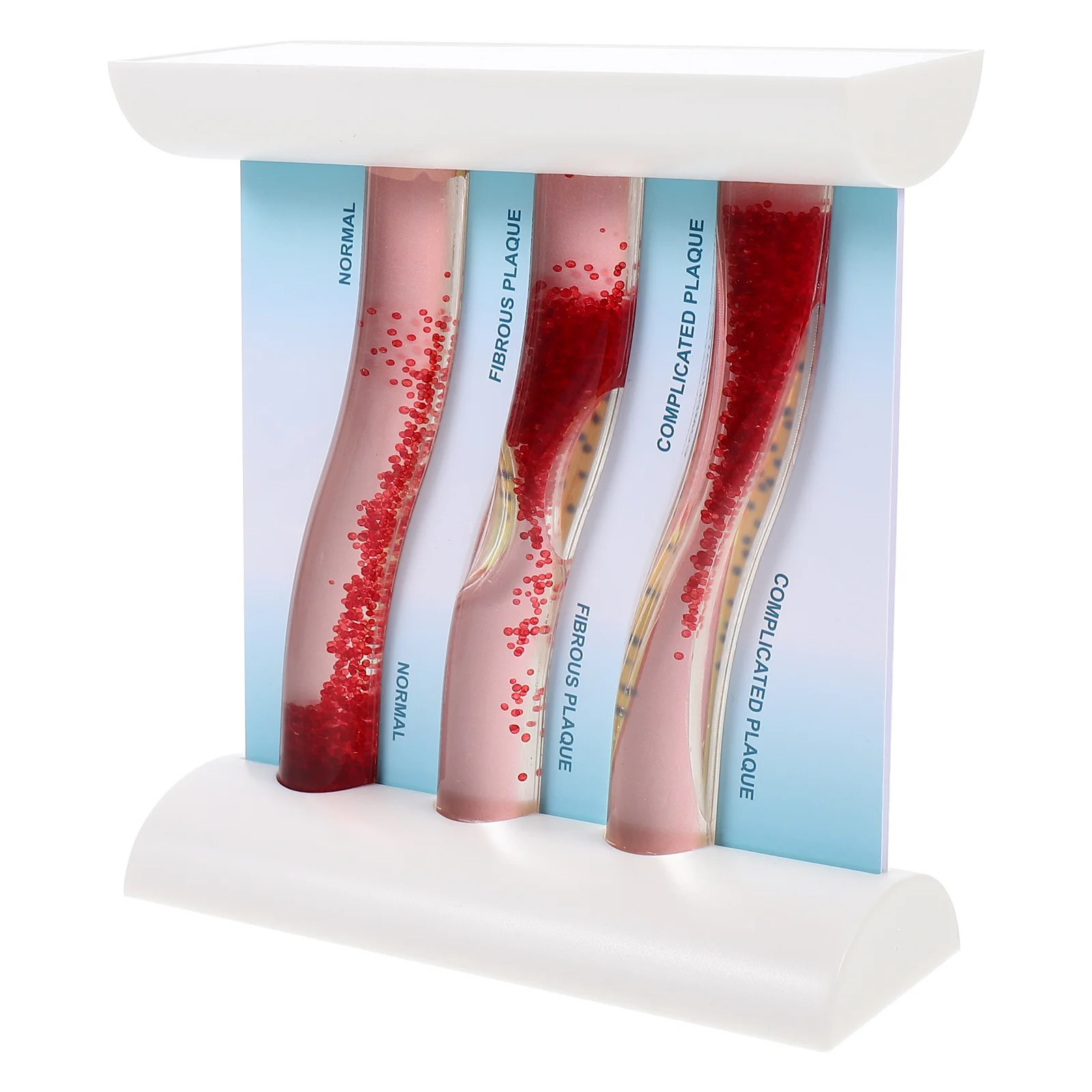 

Dynamic Blood Lipid Vascular Model Anatomical Model Blood Vessel Model Plastic Model Plastic Blood Vessel Model