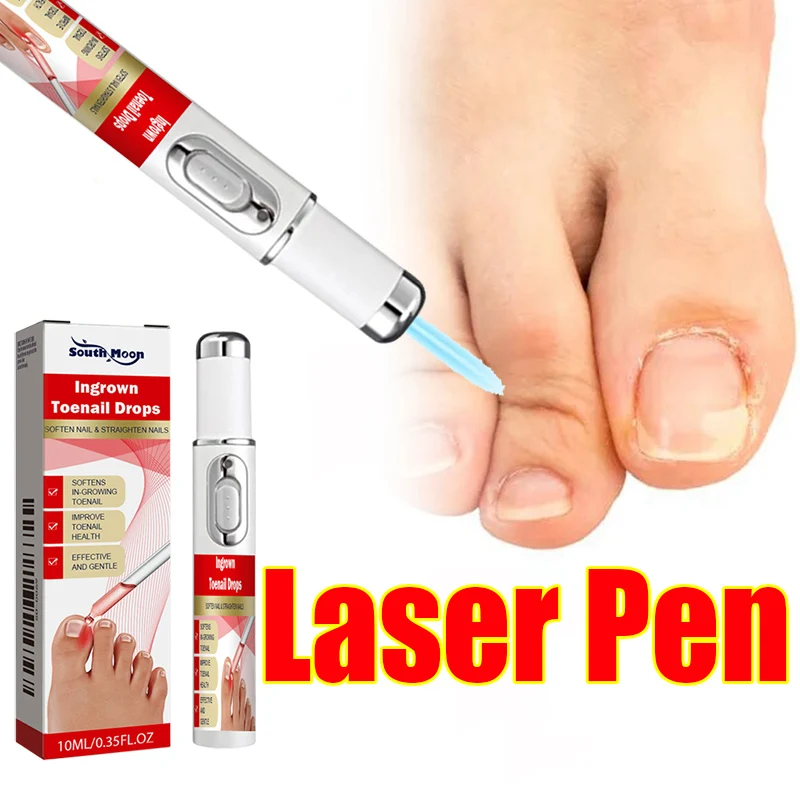 

The laser pen, along with your brand new manicure.