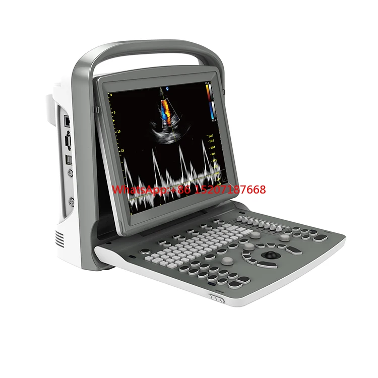 Chison ECO6 Promotion of the cheapest price Full digital ultrasound excellent 3D 4D color Doppler