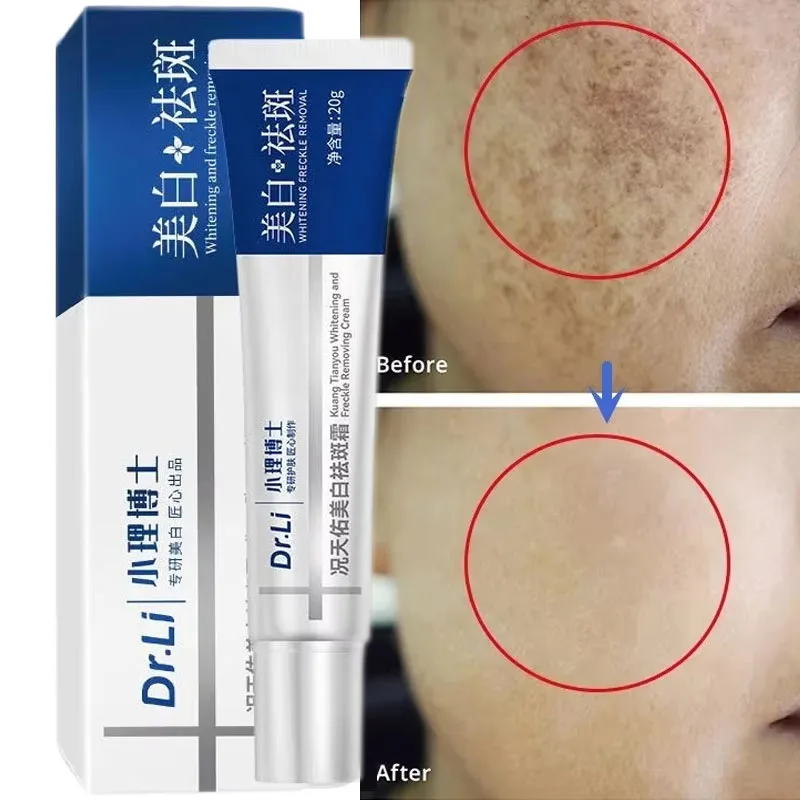 

Effective Whitening Freckles Cream Remove Melasma Dark Spots Fade Pigmentation Moisturizing Brighten Facial Serum Skin Care