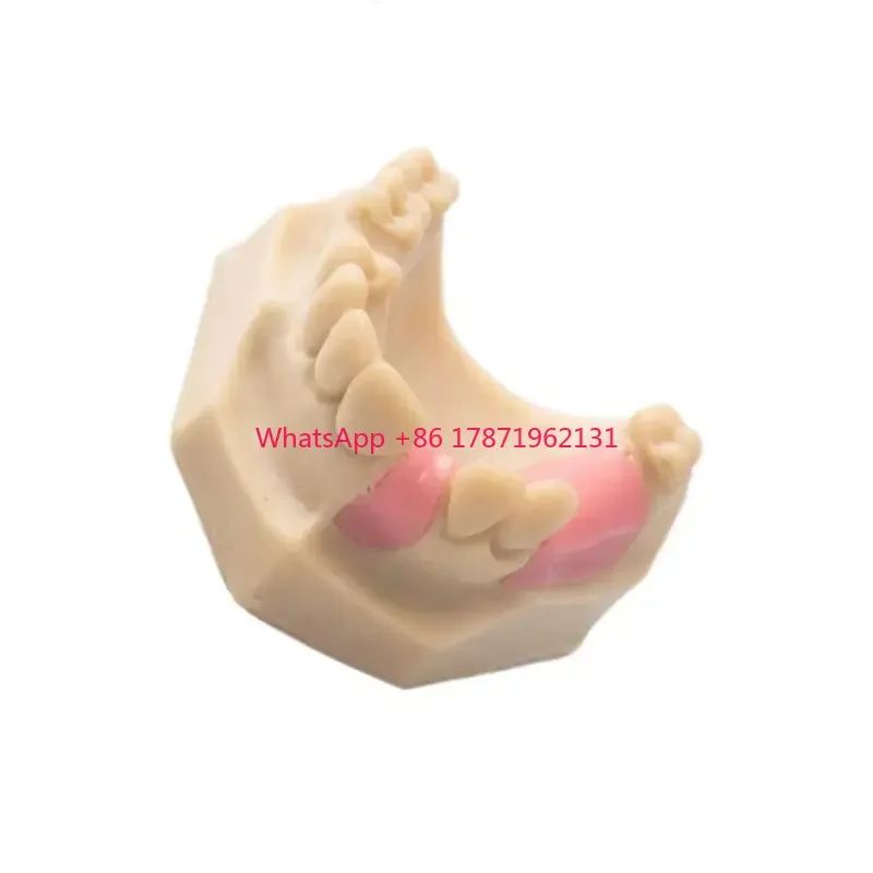 

Easyinsmile dental model education Teeth Upper Jaw Missing model for dental school