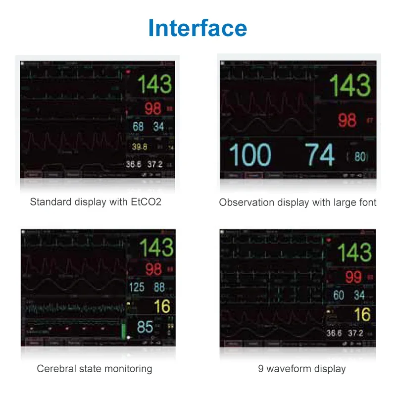 Machine portative de moniteur d'animaux multi-paramétrables, moniteur de patient vétérinaire pour les cliniques d'animaux de compagnie et les gitans VET