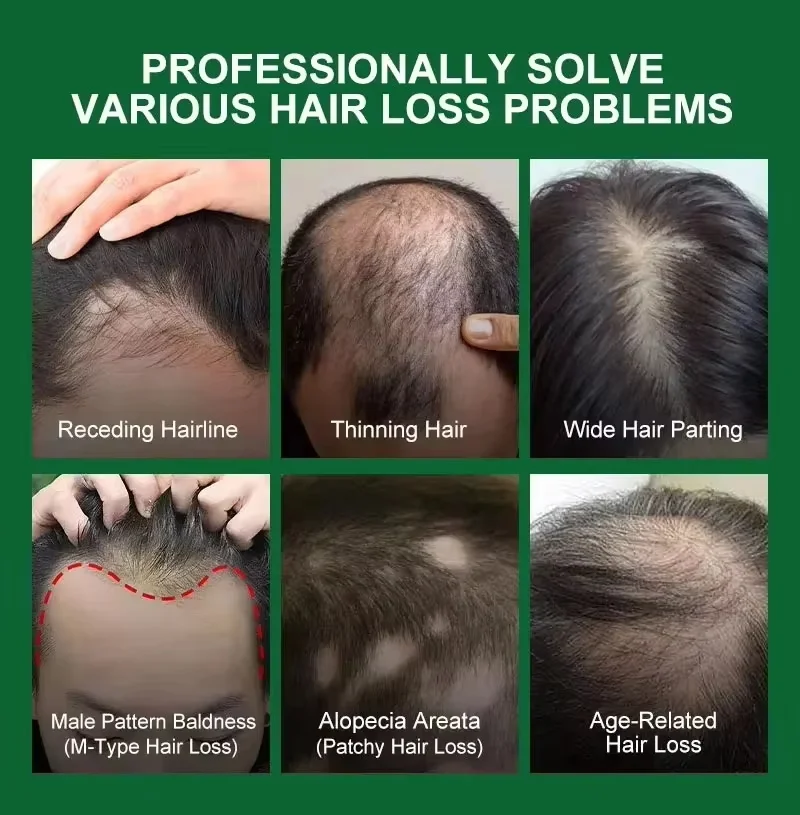 Hair Growth Serum 7 Days Fast Regrowth Essential Capsule Anti Hair Loss Baldness Repair Damaged Scalp Treatment For Women Men view 5