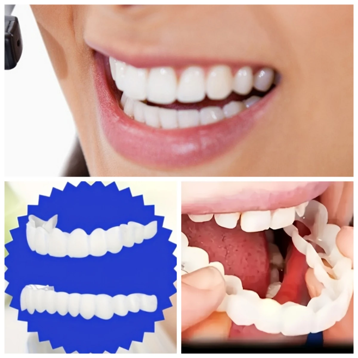 2 Sets Cosmetische Tandheelkun - Teeth Whitening Mask recensie en prijs