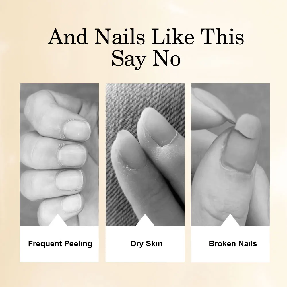 LIMEGIATV-Huile nourrissante universelle pour les ongles, soin de manucure, nutrition des plantes, adoucissement, cuemployrevizer manuellement, N64.Treatment