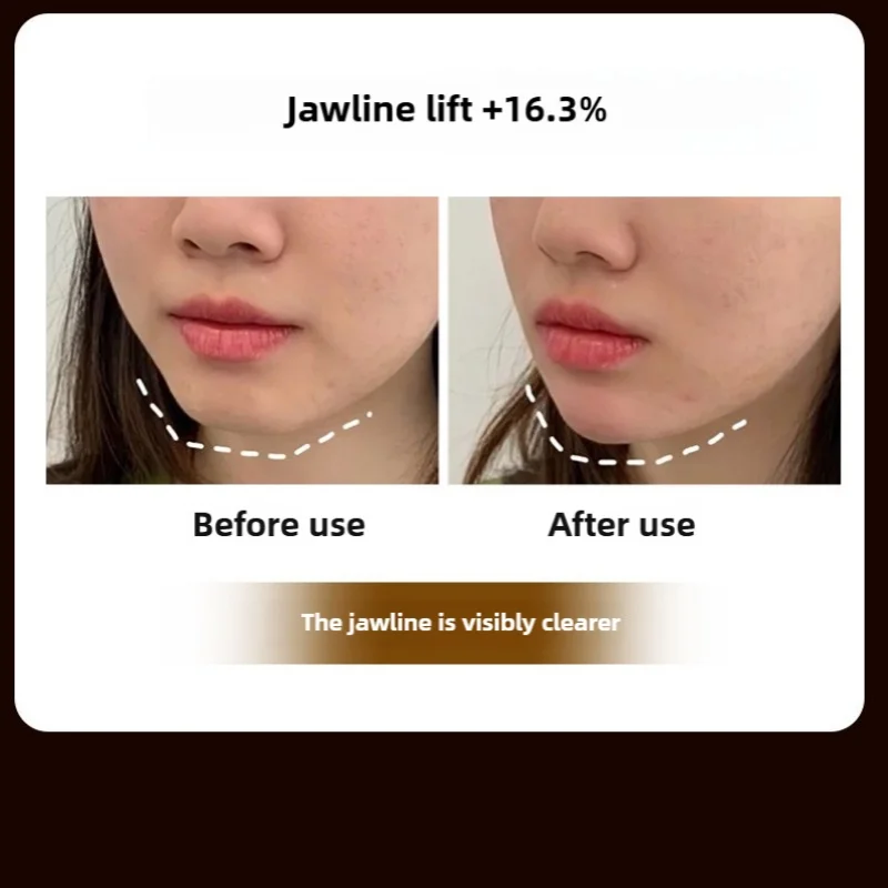 Microcurrent Skin Rejuvenation และ Face Lifting Massager 3D Roller ต่อต้านริ้วรอยกระชับลด Double Chin Face อุปกรณ์ความงาม