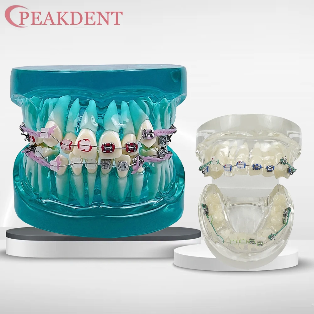 

Dental Orthodontic Treatment Model Standard Teaching Model Dental Teeth Model With Bracket Half Metal Half Ceramic Ties Dentis