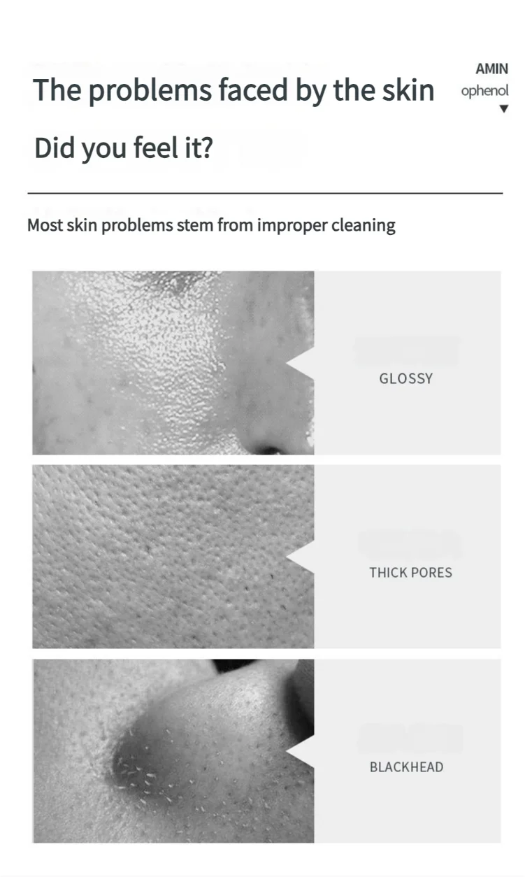 120ml Aminoacidi Mousse Detergente Controllo del Petrolio Pulizia Profonda Rimozione degli Acari Acne Idratante Schiuma Detergente Viso Illumina la Pelle