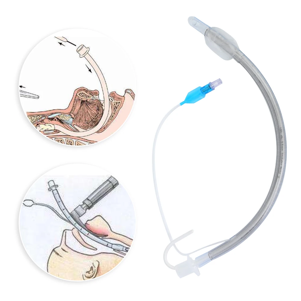 Wegwerp Ontwerp Medische Airway Buis Endotracheale Intubatie Endotracheale Tube Voor Nasale Orale Accessoire (Verbeterde Versie 7.0)