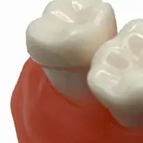 

Dental Gum Model Upper/lower Simulated Gums Dentisit Student Learning Teaching Model Dental Tools Dentisty