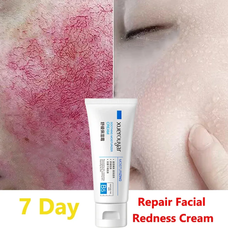 

B5 Facial Redness Repair Cream Rosacea Ance Treatment Repair Sunburn Soothing Sensitive Skin Moisturize Skin Care Korean Product