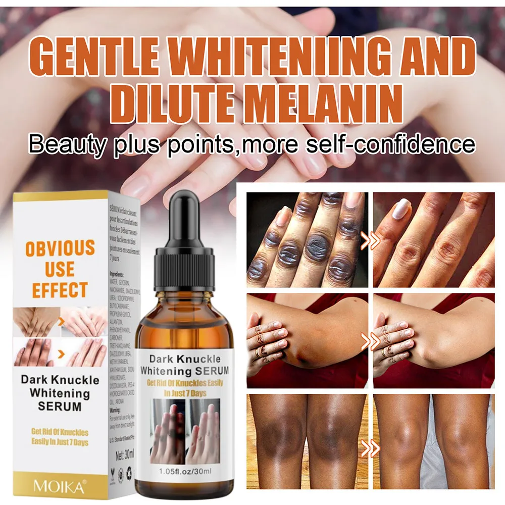 30ml Whitening Serum 7 Days Remover Get Rid Of Dark Knees Dark Knuckle Elbow Cream Nicotinamide Brighten Skin Tone