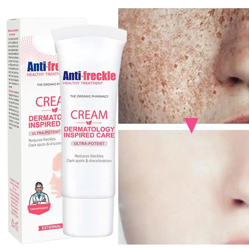 

Whitening Freckle Cream Remove Dark Spots Melanin Melasma Brighten Face Cream Pigmentation Anti-Aging Skin Care Cosmetics