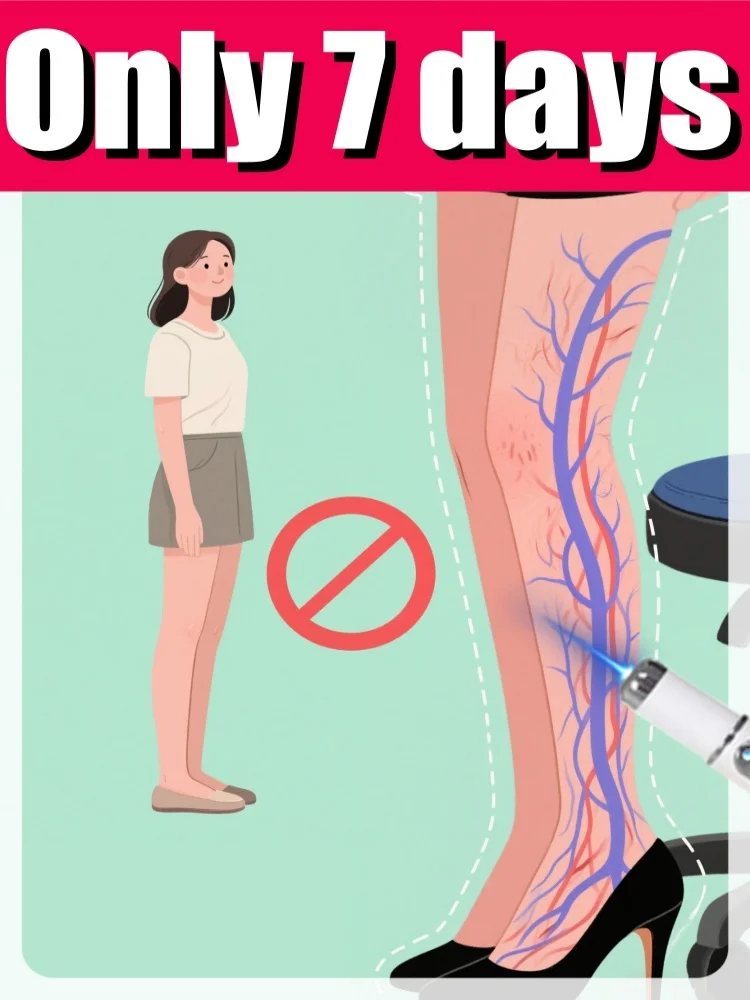 

The new generation of blue light pens is a laser technology tool for varicose in the legs