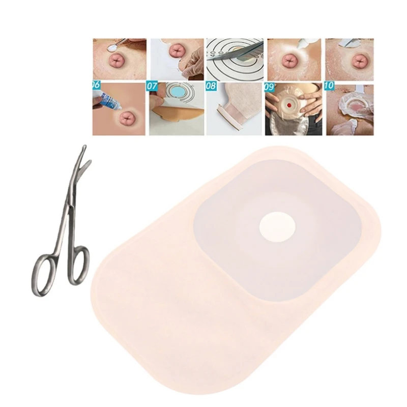 Durable System Colostomy Bags Disposable Ostomy Drainable Single Pouch Stoma Health Care Colostomy Bag Stoma Care Bags