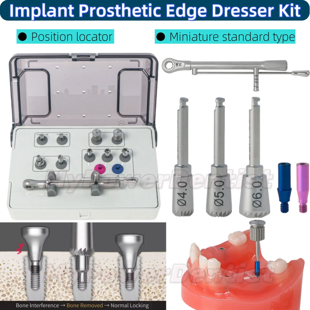 Implant Prosthetic Kit Torque Driver Multi ABT Bone Profiler 4.0/5.0/6.0 M6019