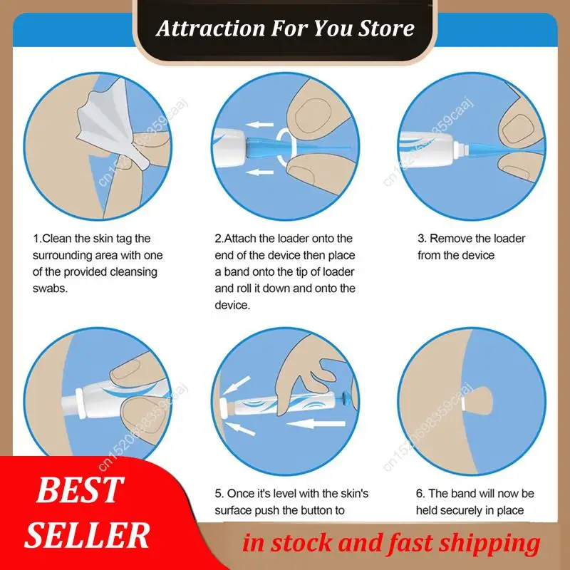 Hot Selling 2X Skin Tag Mole Wart Remover Kit Skin Tag Removal Device With Band Rubber Rings For Adult Mole Wart Face Care Tool