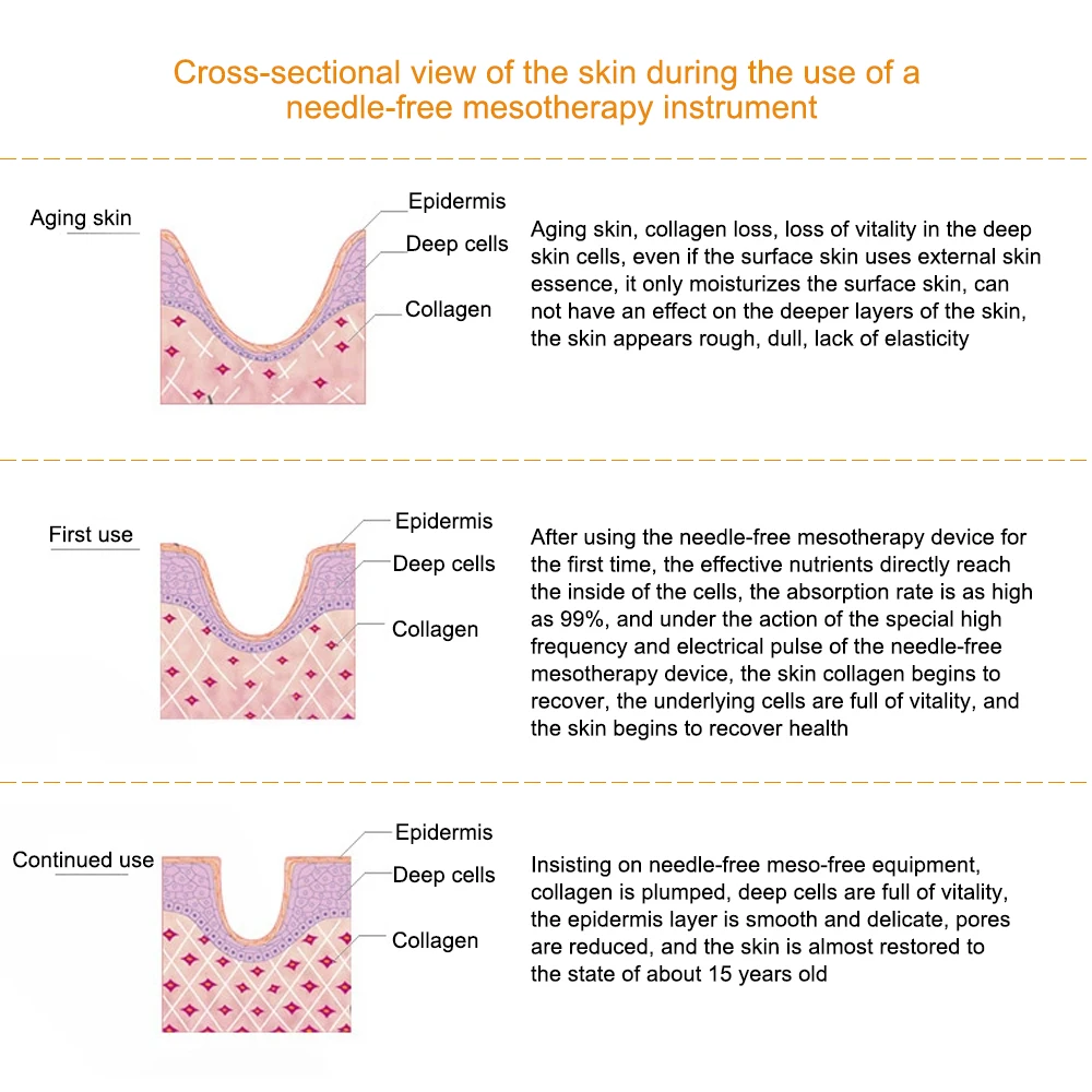 Profissional rf mesoterapia facial led fóton apertar remoção de rugas face lifting ems massageador de rejuvenescimento facial