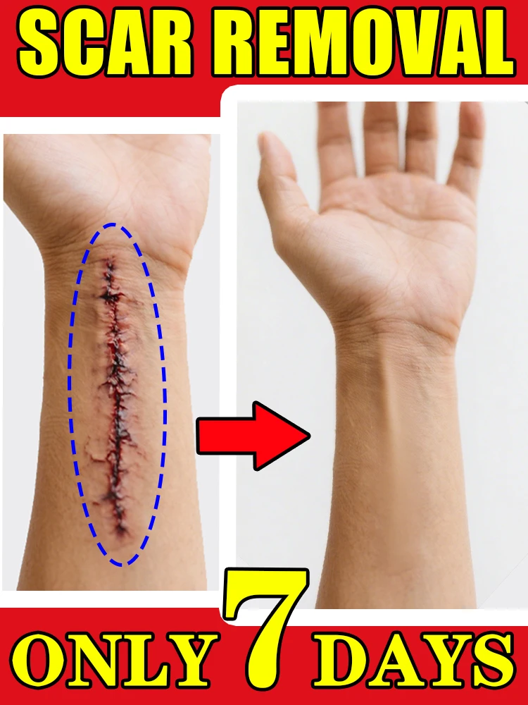 

Whether it is a new ˢᶜᵃʳ ᵒʳ ᵃⁿ ᵒˡᵈ ˢᶜᵃʳ, it can be ᵉᶠᶠᵉᶜᵗⁱᵛᵉˡʸ repaired