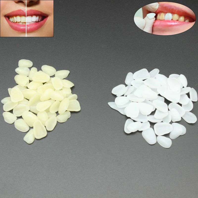 50Pcs Dental Teeth Veneers Ultra Thin Whitening Resin Anterior Temporary Crown False Dentures Repair Dentistry Material