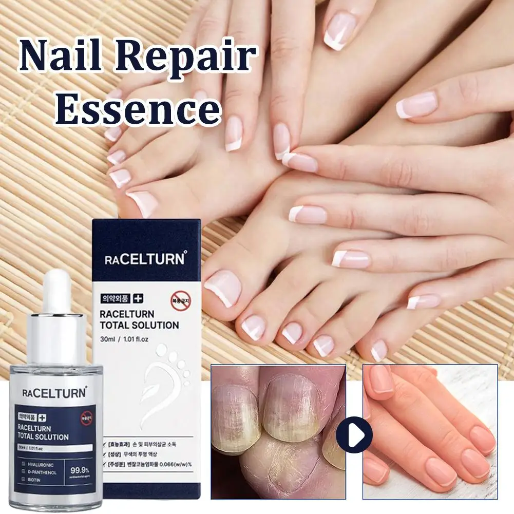 

Сыворотка для ног RACELTURN Total Solution 30 мл — гиалуроновая кислота/D-пентенол/биотин, увлажняющий восстанавливающий, быстро впитывающий, нелипкий