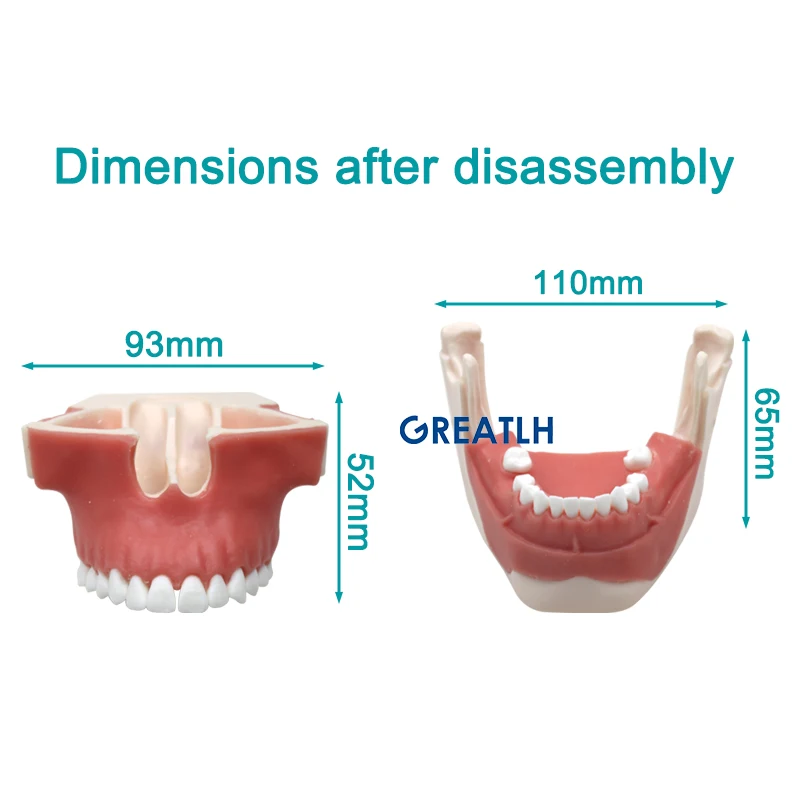 Dental Demonstration Orthodontic Implant Model Detachable Student Learning Practice Model Dental Materials