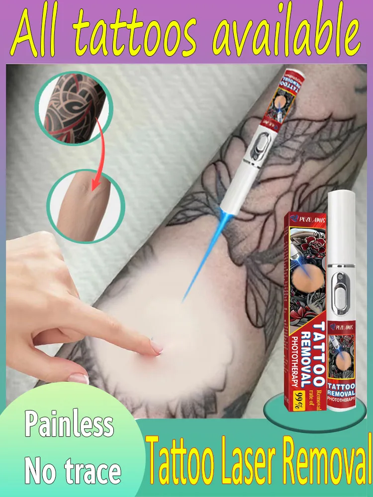 

Precise tattoo removal, fading layer by layer, safe and painless