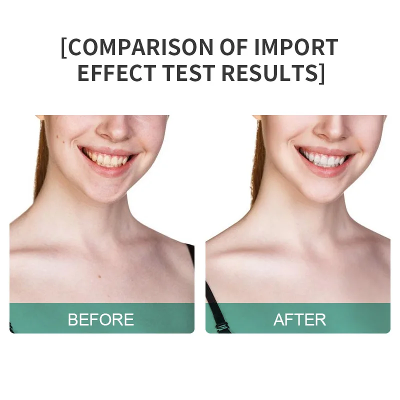 Appareil de beauté 2025 masseur à microcourant appareil de levage du visage et du cou portable raffermissement de la peau Drainage lymphatique rajeunissement de la peau