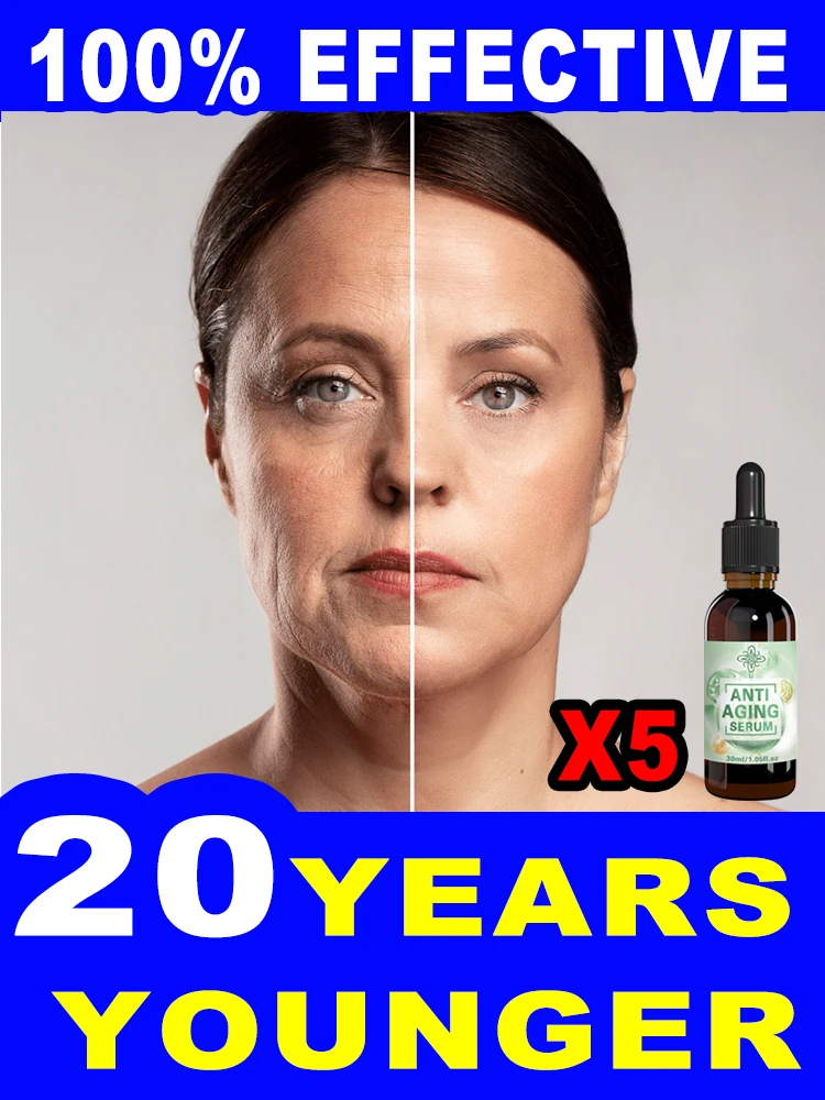 

20 years younger