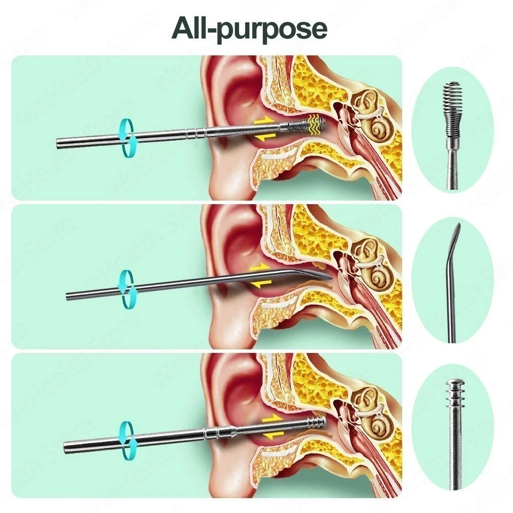 Xiaomi Ear Wax Cleaner Earwax Removal Tool Pick Digging Artifact Earpick Cleaning Ears Remover for Clean Your Kit Gadgets
