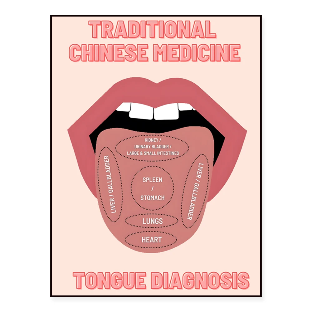 TCM Study Guide, Traditional Chinese Medicine, Tongue Diagnosis Printable Wall Art, Acupuncture Art Poster Gift