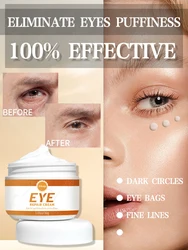 Dark circles cream and eye bag anti bags in the eyes circle remover