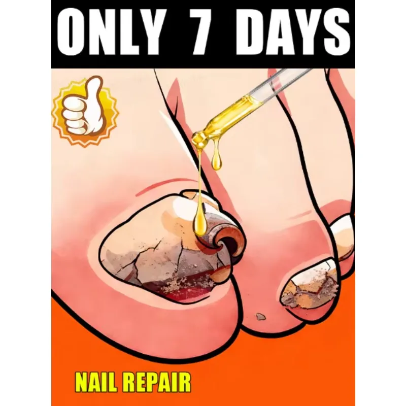 

Qᴜɪᴄᴋʟʏ ᴇʟɪᴍɪɴᴀᴛᴇ ғᴜɴɢᴜs ᴀɴᴅ ʀᴇsᴛᴏʀᴇ ʜᴇᴀʟᴛʜʏ ɴᴀɪʟs