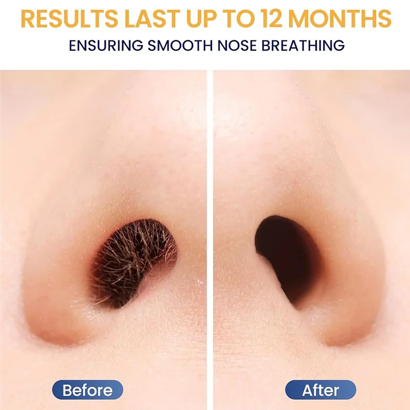 【رابات】أداة توزيع شمع الشعر مع ملعقة للاستعمال مرة واحدة، 100 قطعة من أعواد شمع الأنف لتنظيف الأنف وإزالة شعر الوجه والأذن #5