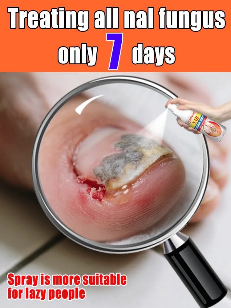 

The most powerful black technology in 2025,ᵉᶠᶠᵉᶜᵗⁱᵛᵉ ⁿᵃⁱˡ ᶠᵘⁿᵍᵘˢ ᵗʳᵉᵃᵗᵐᵉⁿᵗ⸴ ʳᵉˢᵗᵒʳᵉ ⁿᵃⁱˡ