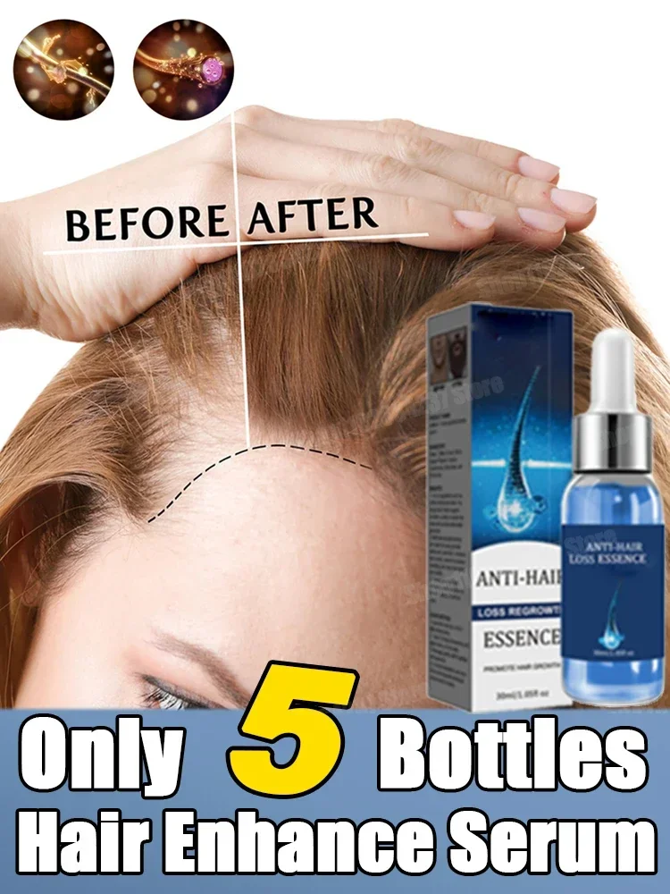 Hair Care Oil for Men Women Anti Hair Loss prevention Scalp nourishment Serum Treatment Products