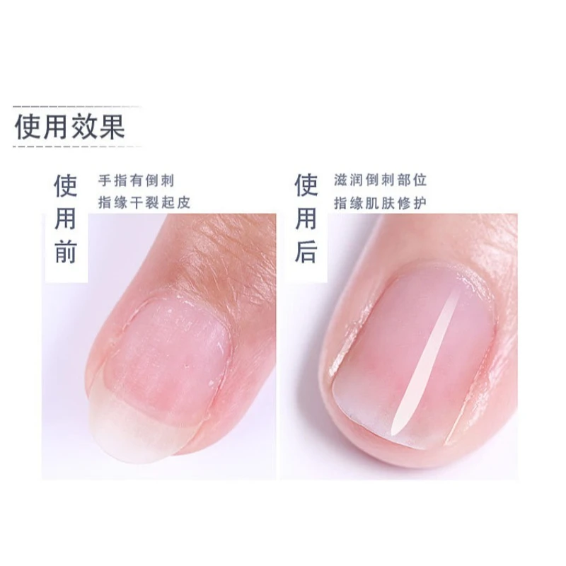 3 ml Nagel Ernährung Öl Stift 15 Gerüche Nagelhaut Revitalizer Öl Anti-barb Nagel Rand Öl Nagel Behandlung stärkung Pflege Werkzeuge