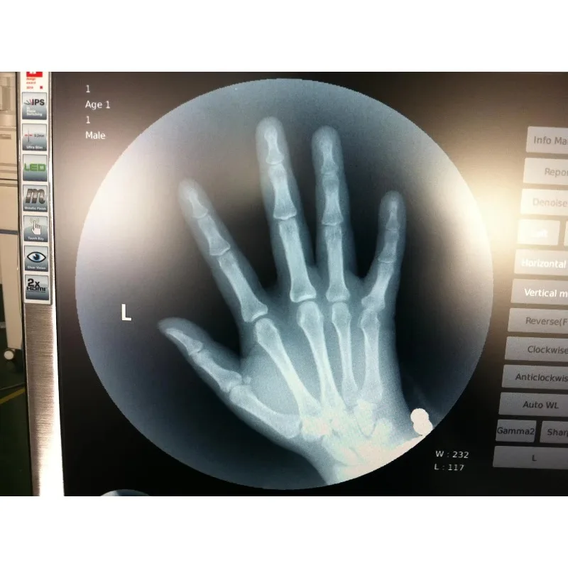 Mobile fluorescence microscope x-ray c-arm