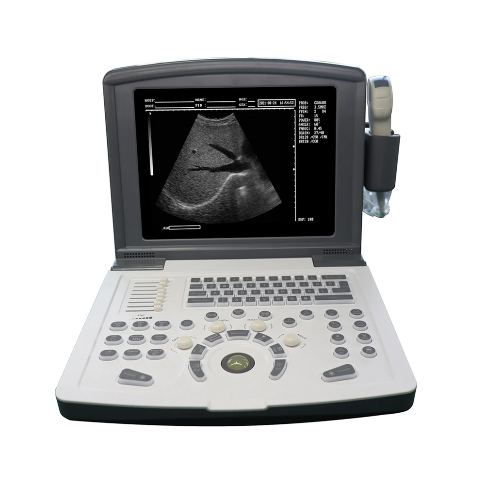 12 Inch Battery Black And White Diagnostic Portable Ultrasound Scanner Machine